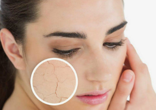 Một số điều tuyệt đối không được làm với làn da nhờn, nhằm mục đích là tránh gây tổn thương da
