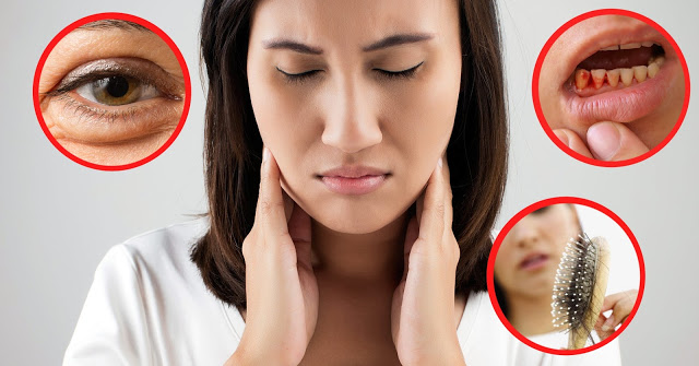 5 dấu hiệu thiếu vitamin biểu hiện rõ trên khuôn mặt